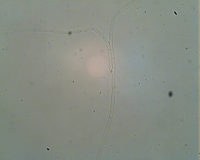 Asterostroma laxum Bres. (1920)